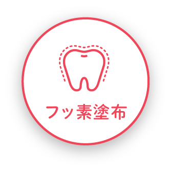 フッ素塗布
