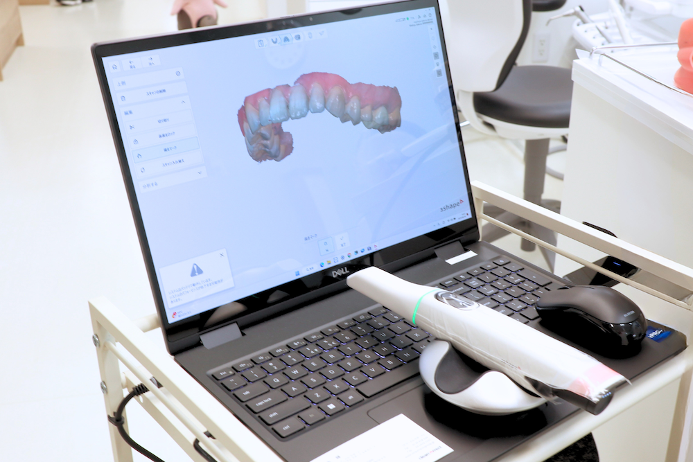 町屋さくら歯科・矯正歯科の口腔内スキャナー