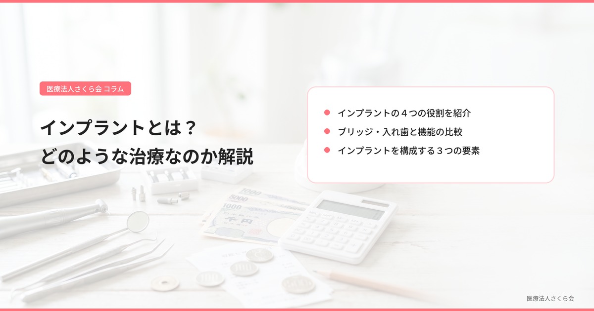 インプラントとは？どのような治療なのか解説
