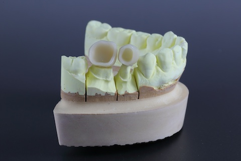 CADCAM