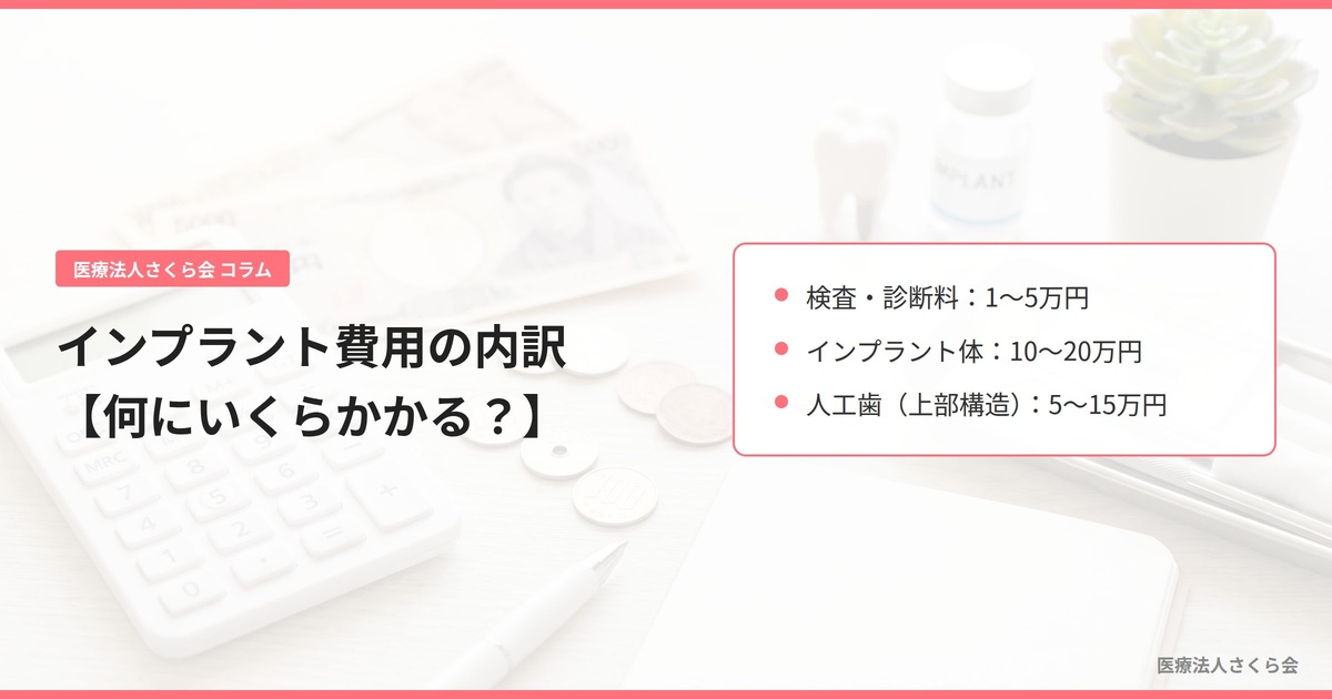 インプラント費用の内訳【何にいくらかかる？】