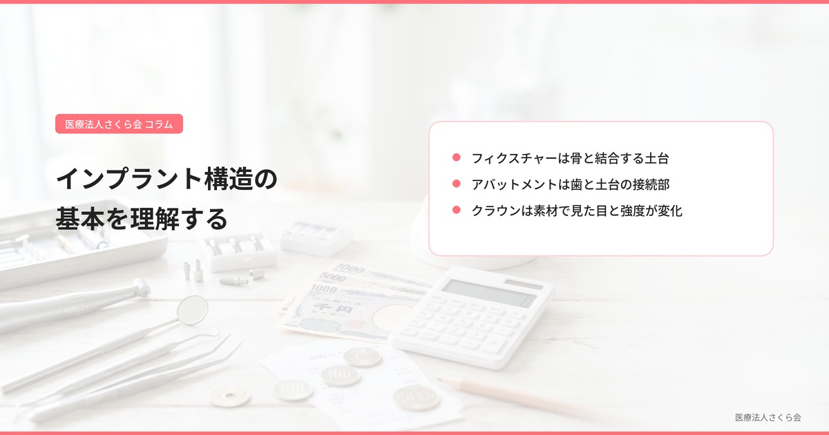 インプラント構造の基本を理解する