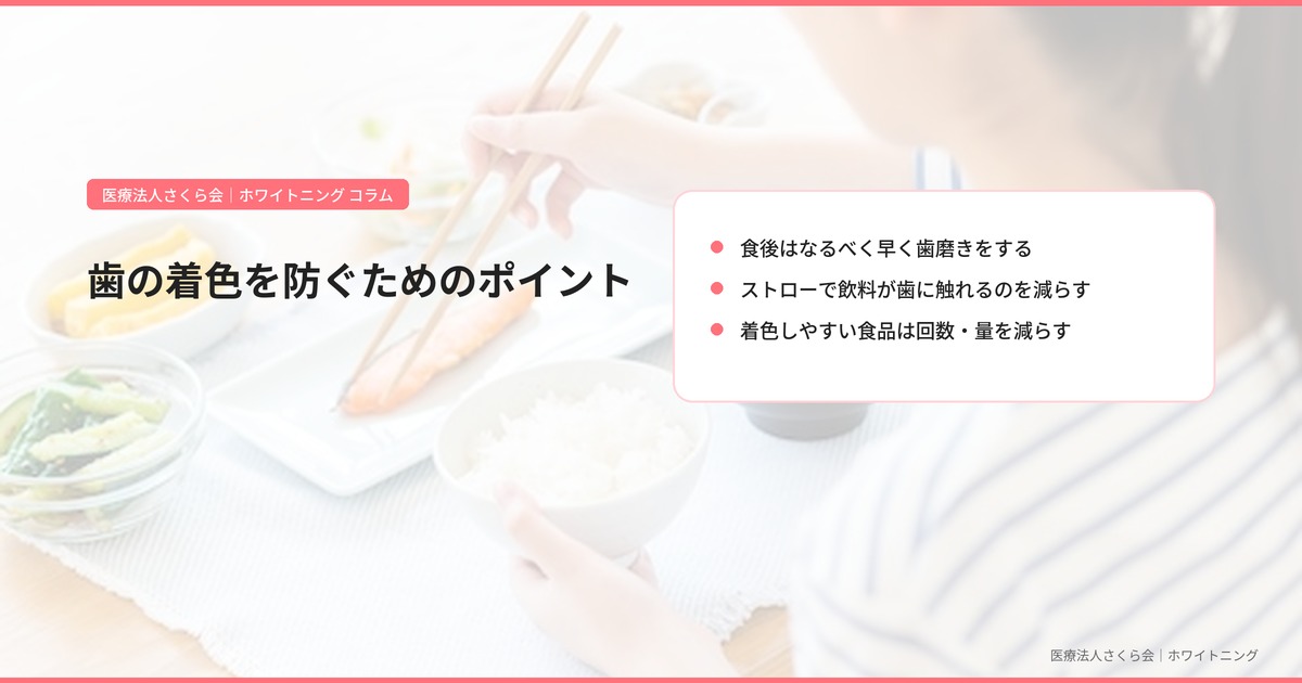 歯の着色を防ぐためのポイント