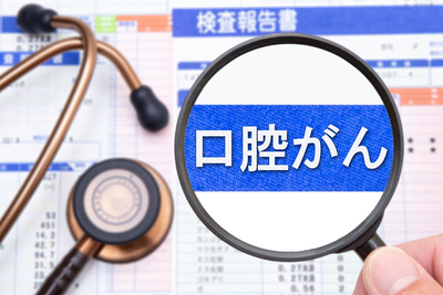 口腔がんの種類