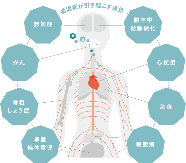 歯周病が引き起こす病気の図